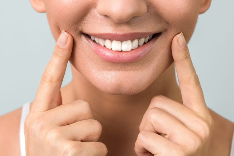 Benefits of Visiting a Hollywood Smile Dental Clinic